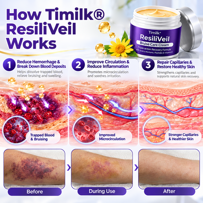 Timilk® ResiliVeil Bruise Care Cream.