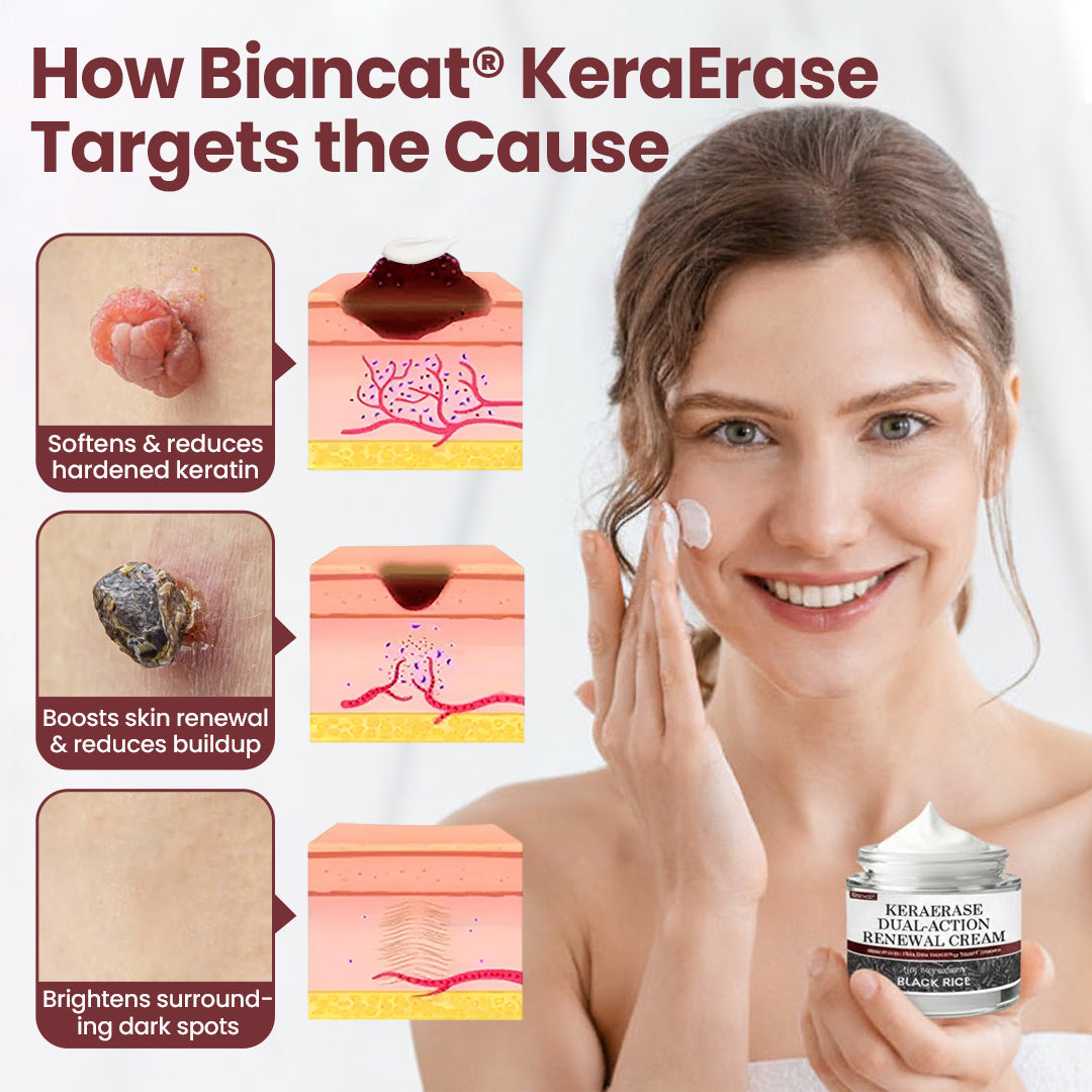 Biancat® KeraErase Dual-Action Renewal Cream.