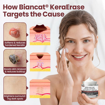 Biancat® KeraErase Dual-Action Renewal Cream.