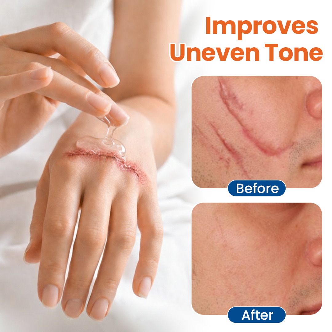 Timilk® DermalRebuild Skin Renewal Gel.