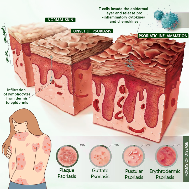 Timilk® DermaPure Tea Tree Healing Cream.
