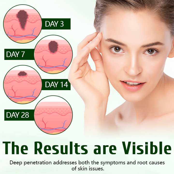 Timilk® DermaPure Tea Tree Healing Cream.