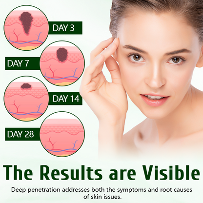 Timilk® DermaPure Tea Tree Healing Cream.