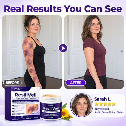 Timilk® ResiliVeil Bruise Care Cream.