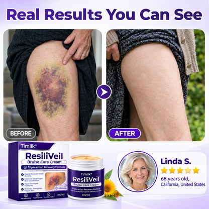 Timilk® ResiliVeil Bruise Care Cream.