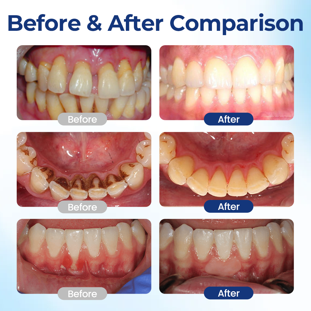 Biancat® BeeTakt Oral Repair Solution.