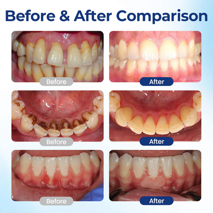 Biancat® BeeTakt Oral Repair Solution.