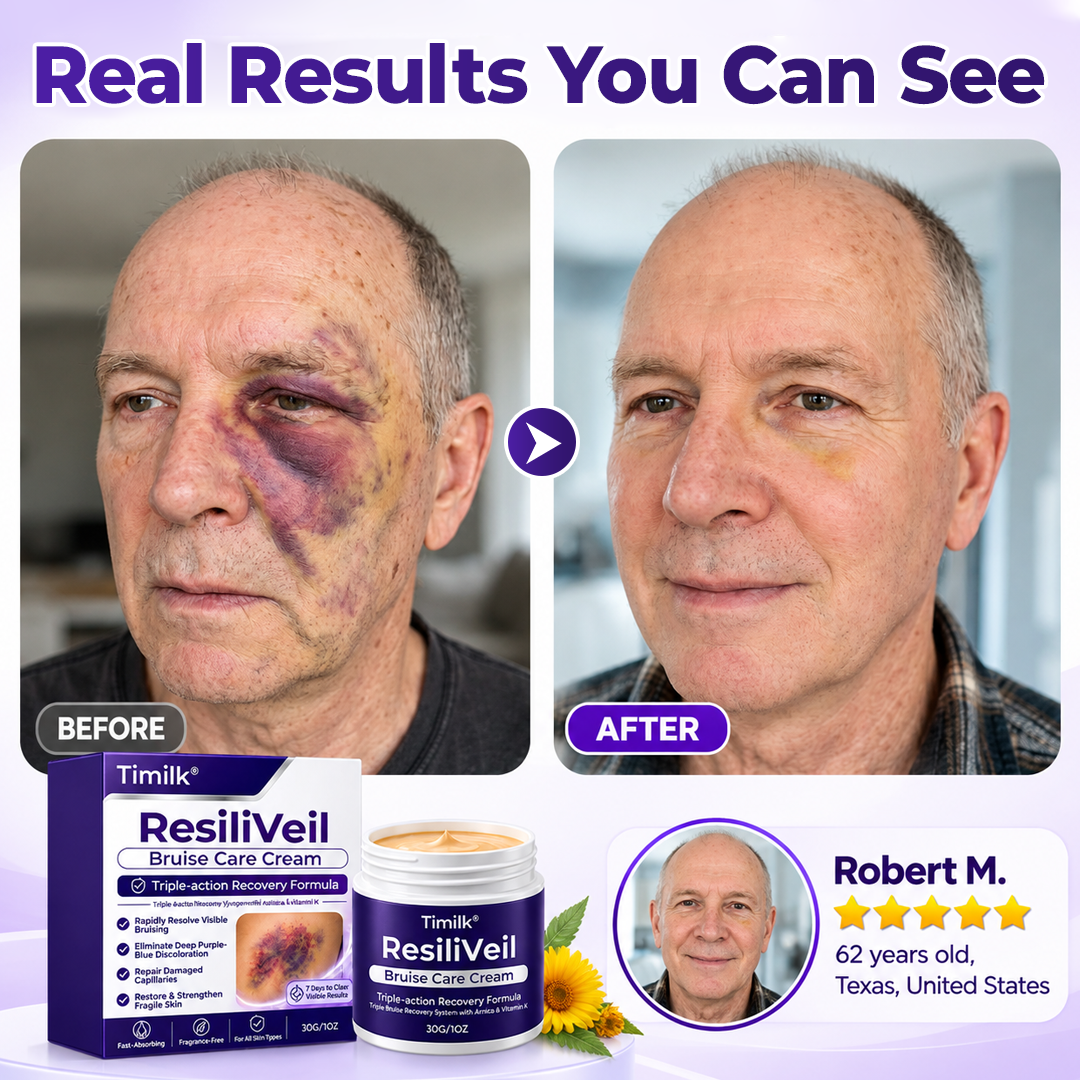 Timilk® ResiliVeil Bruise Care Cream.